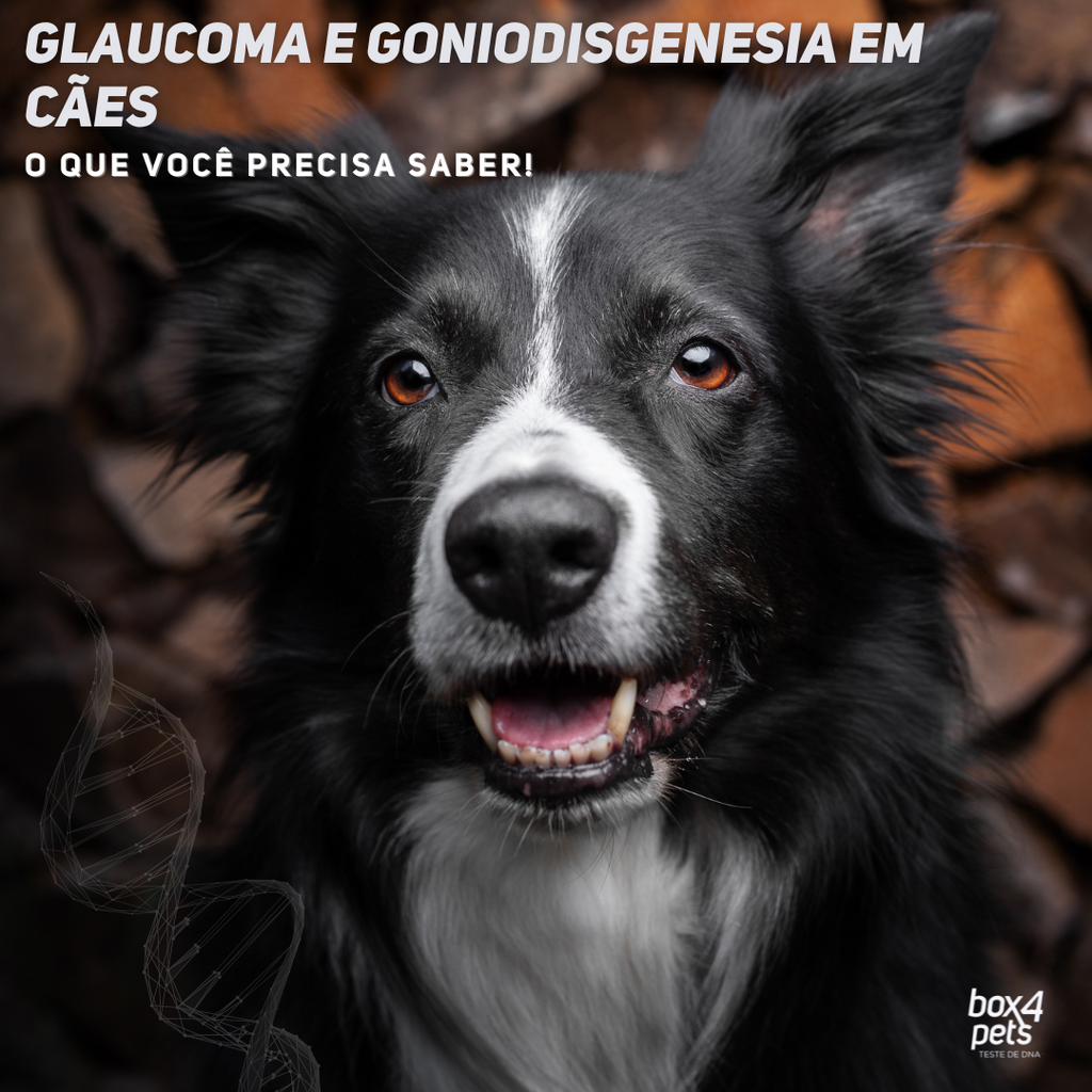 Goniodisgenesia e Glaucoma